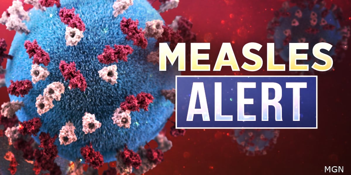 Nine cases of measles in Williams County Nine cases of measles in Williams County