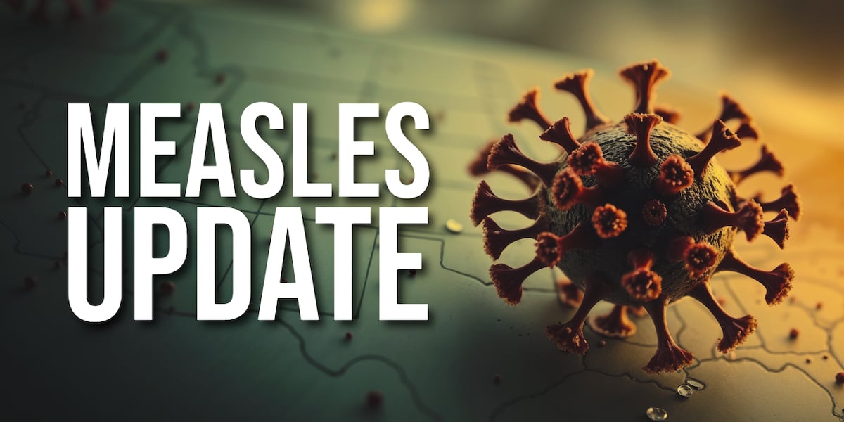 Pair of measles cases confirmed in Cass County; state total 11 in ’25